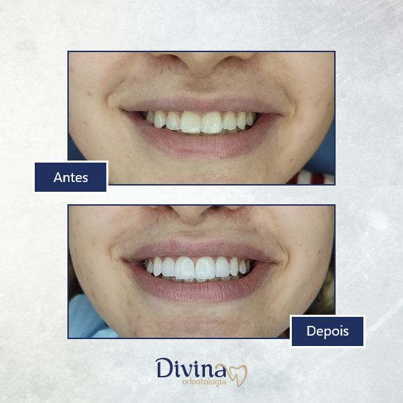 Caso clínico Divina Odontologia - Tratamento odontológico 1